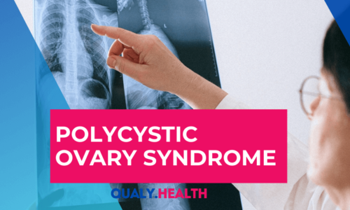 Polycystic ovary syndrome