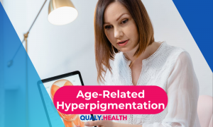 Age-Related-Hyperpigmentation