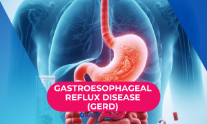 Gastroesophageal reflux disease (GERD)