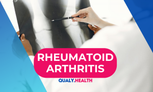 Rheumatoid-Arthritis